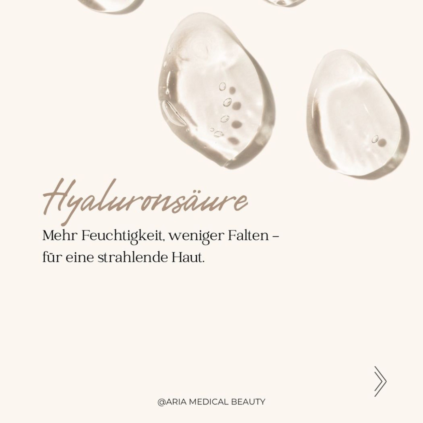 Hyaluronsäure Behandlung, Aria Medical Beauty